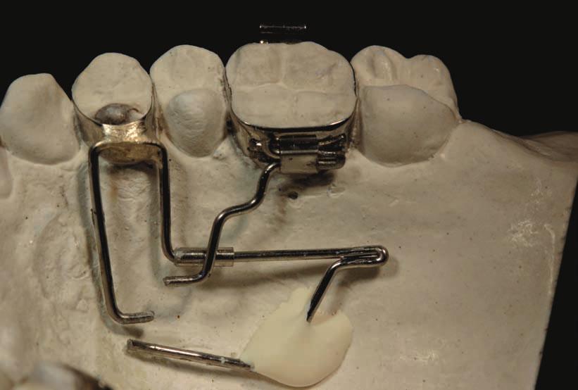 premolars. Fig. 7.