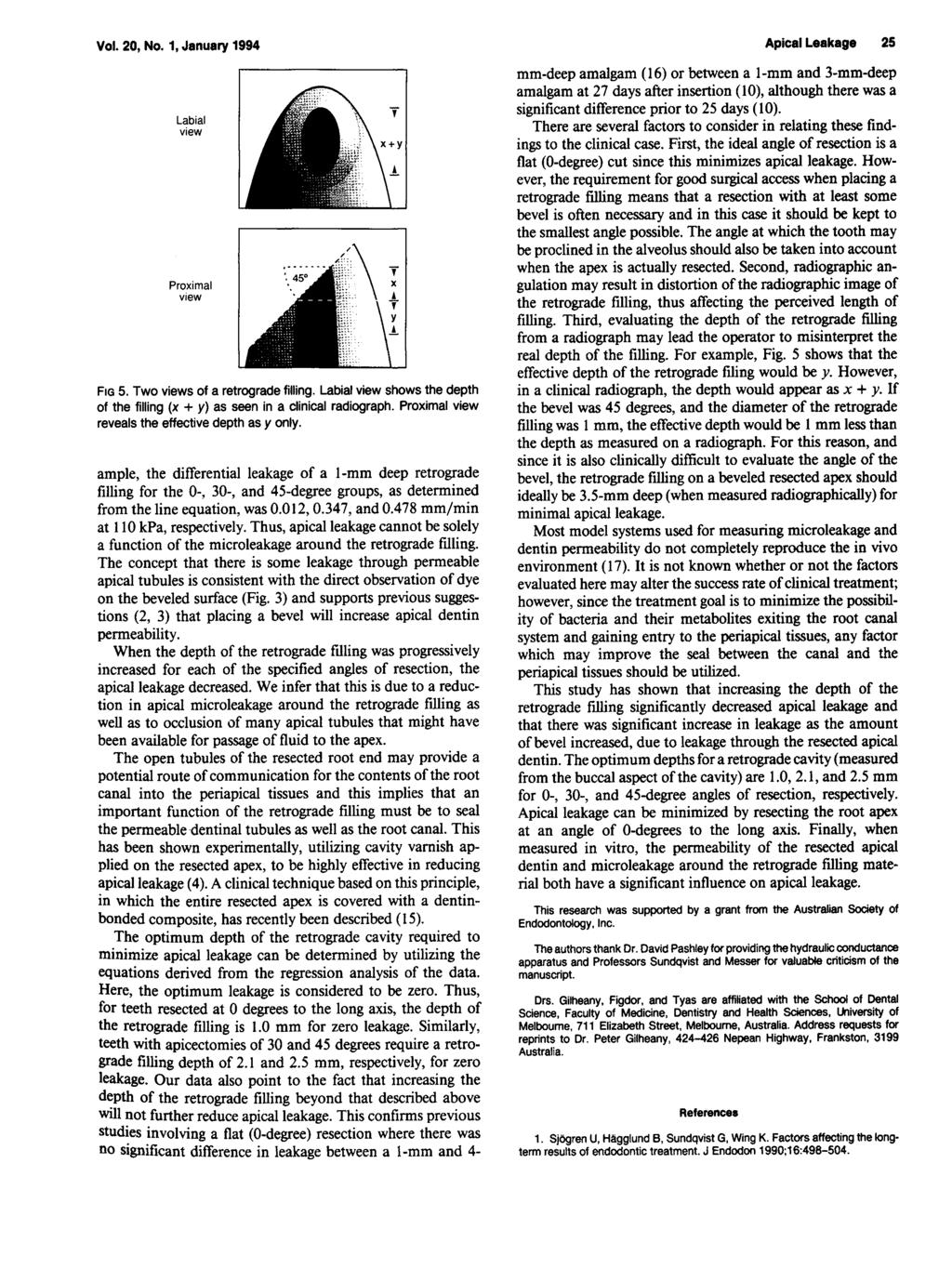 Vol. 20, No. 1, January 1994 Labial Proximal FG 5. Two s of a retrograde filling. Labial shows the depth of the filling (x + y) as seen in a clinical radiograph.