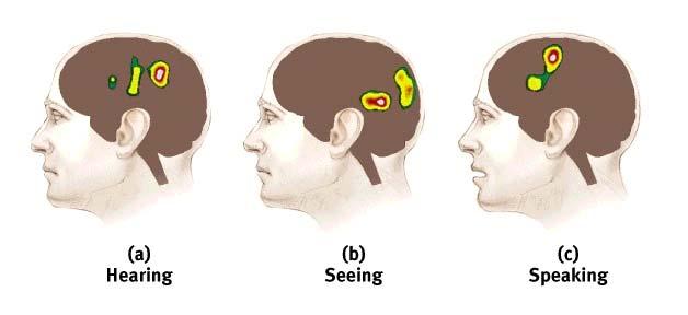 directs the muscle movements involved in speech Wernicke s Area an area of the left temporal lobe involved in language