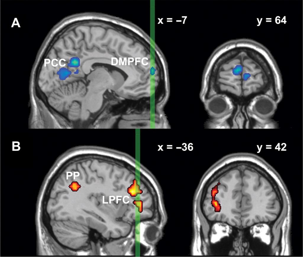 Self-Focused (blue) and Open Awareness (red) Conditions (in the novice, pre MT