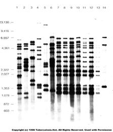 RFLP=Restriction fragment Length Polymorphism Restriction endonuclease makes DNA fragments Separate fragments by electrophoresis IS 6110 as DNA probe= Insertion sequence occurring repeatedly at