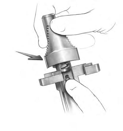 38 NexGen LPS Fixed Bearing Knee Surgical Technique Figure 72 Figure 73 Tibial Plate Preparation (cont.