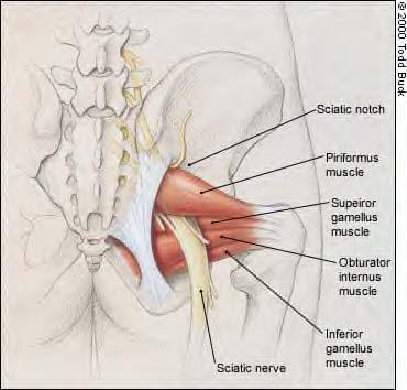 Piriformis muscle syndrome Hip External Rotator Can be source of Hip Bursitis