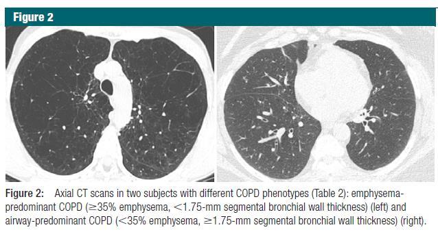 com In COPDgene, 357 of 858 smokers with nmal spirometry had emphysema on CT Symptoms/function as imptant as FEV1 on survival BODE: Dyspnea, 6MWT, BMI, FEV1 GOLD