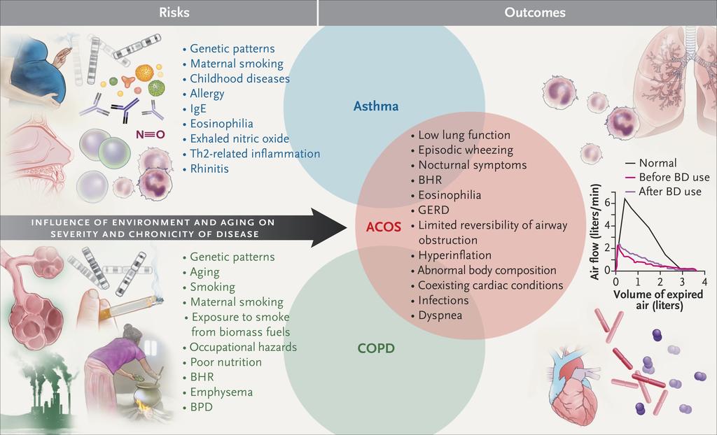 Risk Factors for Asthma and COPD and the Influence of