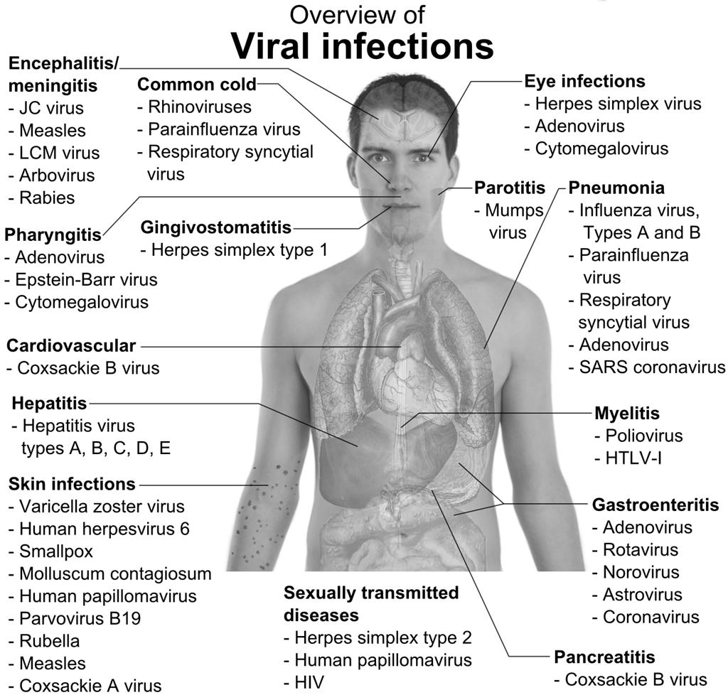 3. 1. 2. 4. 1. Influenza Influenza Influenza Common cold