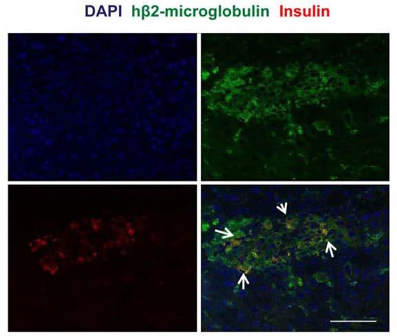 unrescued (G) mice showed reduction of insulin