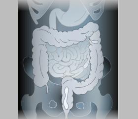Barium Enema Unit 1: Introduction In a double-contrast or air-contrast study, the colon is first filled with barium and then the barium is drained out, leaving only a thin layer of barium on the wall