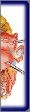 endometrium and in peritoneal