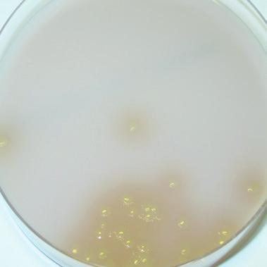 4 CFU/mL 10 3 CFU/mL Interpretation of bacteriuria: