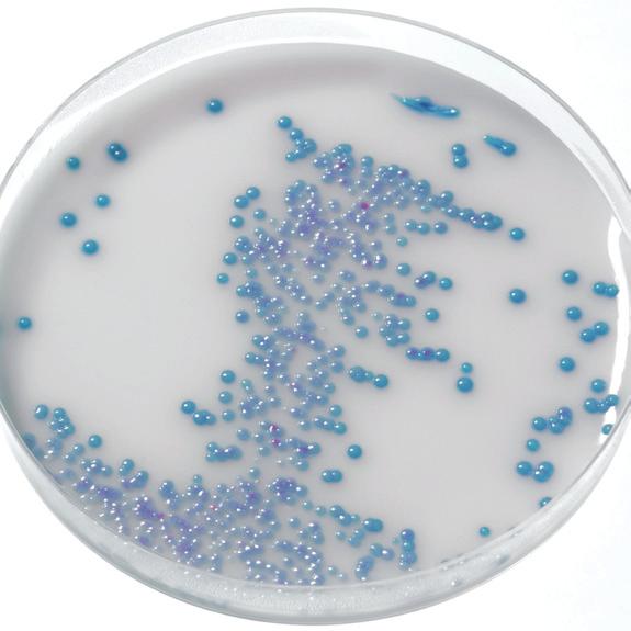 E. coli, Proteus