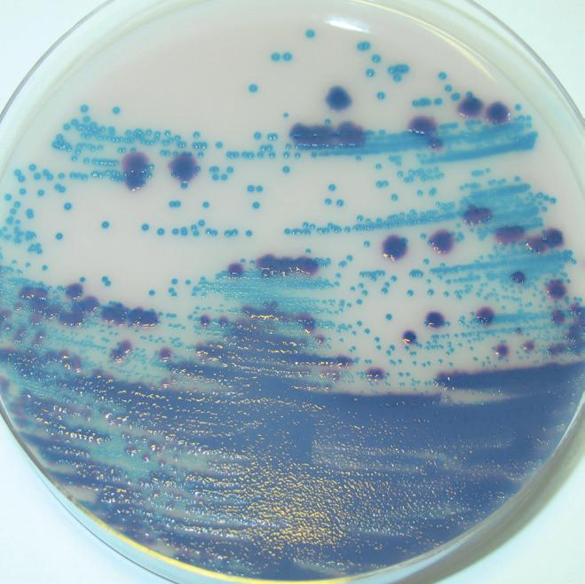 Pathogens Identification Observation of the color of