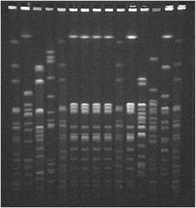 (PFGE) DNA fingerprinting Epidemiological purposes Cluster detection Outbreak investigation Prevention effectiveness Procedure that determines the order of bases in genome of an organism in one
