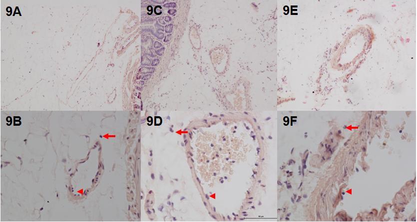 Figure 9: Representative pictures of leukocytes by H&E staining of mesenteric tissues from Krebs control (9A & 9B), 50 M L-NAME (9C & 9D), and 100 M BH 2 (9E & 9F).