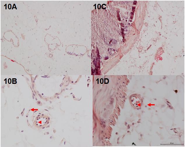 32 Figure 10: Representative pictures of leukocytes by H&E staining of mesenteric tissues from 200 M BH 2 (10A & 10B) and 250 M BH 4 (10C & 10D). 10A & 10C are at 10x while 10B & 10D are at 40x.