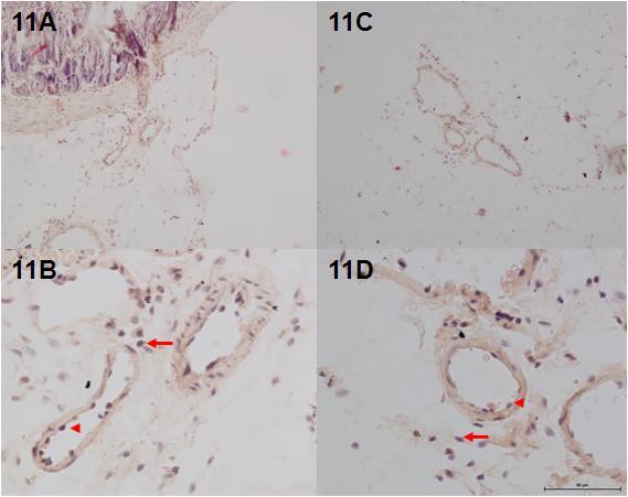 33 Figure 11: Representative pictures of leukocytes by H&E staining of mesenteric tissues from 100 M BH 2 /100 M BH 4 (11A & 11B), and 100 M BH 2 /250 M BH 4 (11C & 11D).