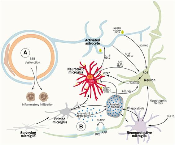 Neuroinflammation Journal of Cerebral