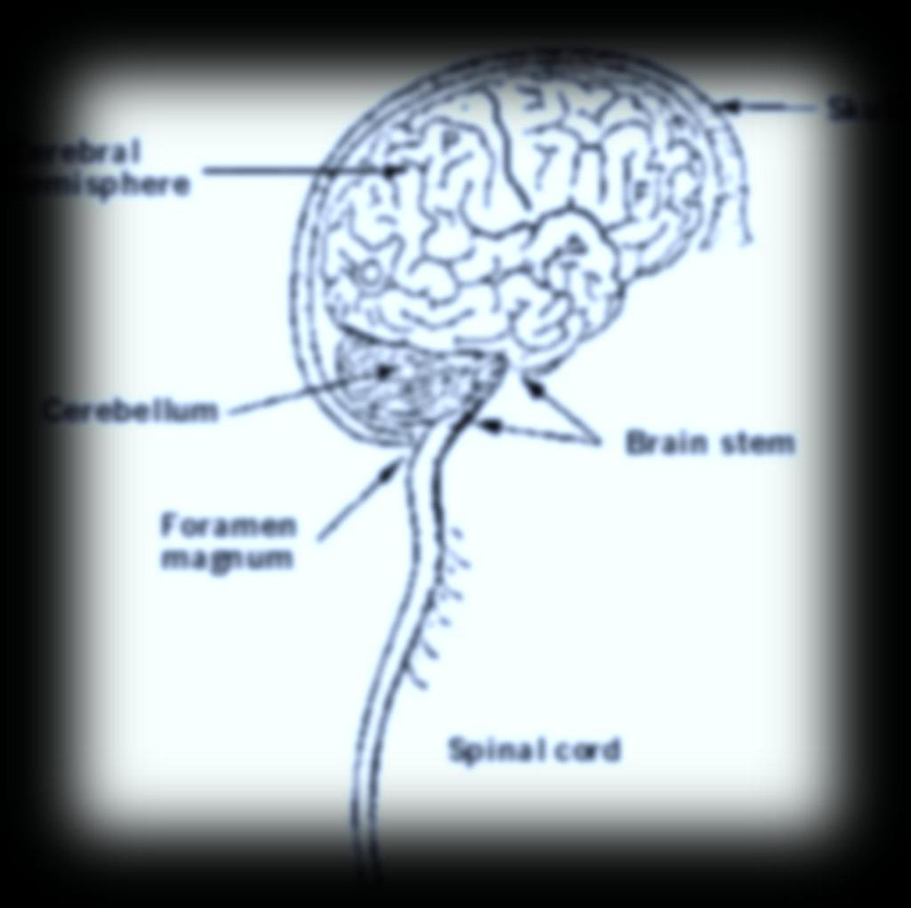 Brain tumors are: Primary brain tumors - those that begin in the brain and tend to stay in the brain -