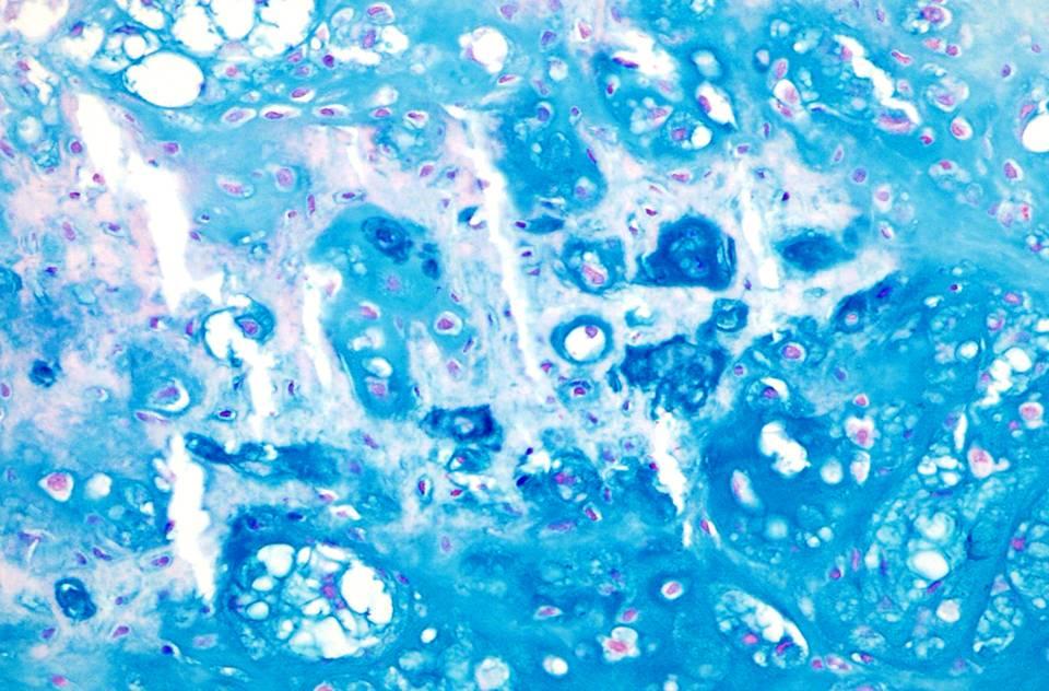 Alcian Blue Extracellular matrix
