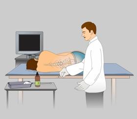 What are the Risks? A lumbar puncture is considered a safe procedure with minimal risks.