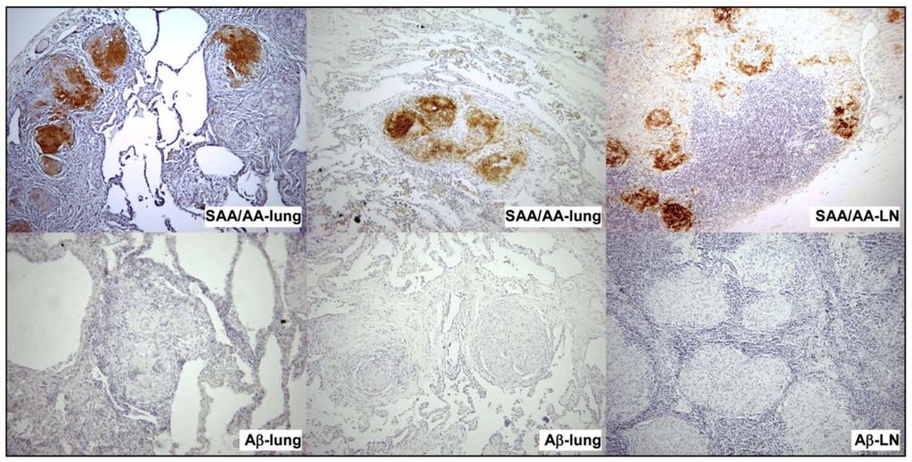 SAA is highly expressed in granulomas