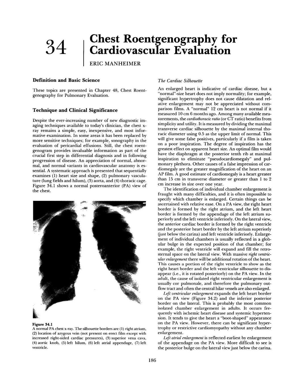 34 Chest Roentgenography for Cardiovascular Evaluation ERIC MANHEIMER Definition and Basic Science These topics are presented in Chapter 48, Chest Roentgenography for Pulmonary Evaluation.