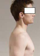 THORACIC SPINE (UPPER BACK) POSTURE In the side view, the thoracic spine has a mild backward curve.