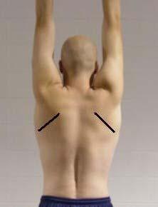 REAR VIEW - ARMS OVERHEAD The rear view - arms overhead provides information regarding the ability to fully flex or abduct the shoulders