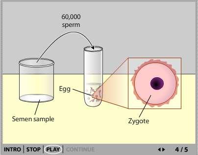 Introduction to In vitro fertilisation (IVF) http://www.sumanasinc.