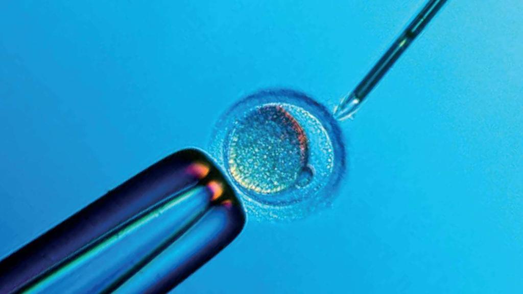 6.6.A4 The use in IVF of drugs to suspend the normal secretion of hormones, followed by the use of artificial doses of hormones to induce superovulation and establish a pregnancy.
