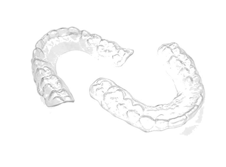 4 A ssesment There are 2 type of treatment A-In case we can align your teeth sending you directly at home the aligners, No need to go to the Sonrisa on-line center, Remember you get a discount when