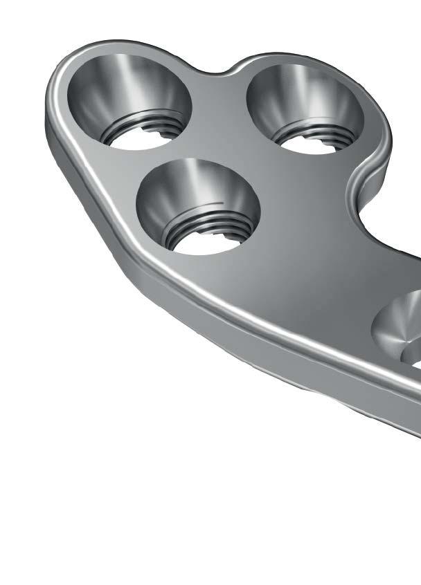 IMPLANT FEATURES PLATE DESIGN Holes The DePuy Synthes Vet Mini TPLO plate is designed with two distinct screw-hole technologies to accommodate all plating modalities.
