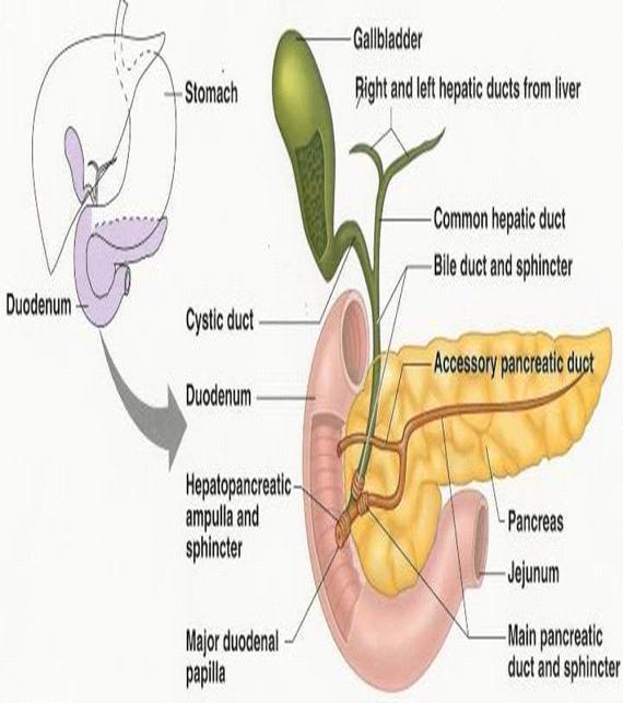 The single gall stone is formed here due to the susceptible nature of this region as it is pouch, so stasis occurs to the bile and with the extensive absorption of water.