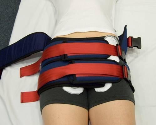 pubis and the greater trochanteric region Strap 3: positioned strap at the level of the symphysis pubis and ischial tuberosity (placed below strap 2) In a time critical situation if the middle strap