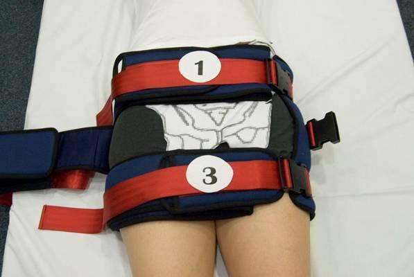 Pressure Area Care Nursing care of the patient with a Pelvic binder requires close monitoring of the patients, haemodynamic status as well as skin integrity.