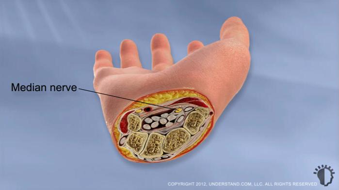 What Causes Carpal Tunnel Syndrome The median nerve controls thumb movement and provides sensation from the palm side of the thumb to half of the ring finger.