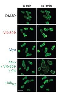 VX-809 Myo + VX-809 Myo + C4 + VX-809 FIS (% of VX-809) Organoids: Report on DF508-CFTR correctors 400 300 200