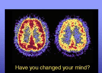 USING DRUGS OR ALCOHOL AS A TEEN RISKS DAMAGING YOUR BRAIN. Alcohol and many drugs can damage brain cells. Damaged brain cells could mean: You find it hard to make decisions.