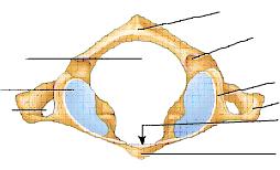 Atlas (C1) Posterior tubercle Vertebral foramen Superior articular facet Transverse foramen Tubercle for transverse ligament