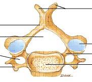 Typical Cervical Vertebra Spinous process (bifid) Lamina Vertebral foramen Transverse