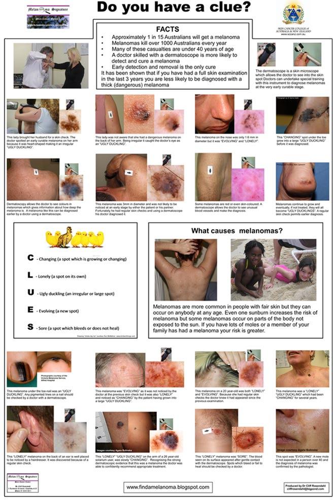 References Figure 13. The patient education poster, which prompted a teenager to suggest that her teacher consult his general practitioner about a discoloured thumbnail.