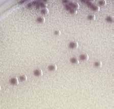 HardyCHROM Vibrio was developed as a medium for differentiating Vibrio cholerae, Vibrio