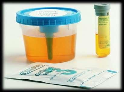 Urine collected in sterile specimen container must be processed within 2 hours, or refrigerated and processed within 24 hours