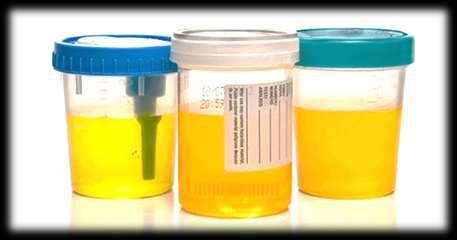 Normal urine is sterile, but it may become contaminated with microbiota of the skin near the end of its passage through the