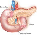 duodenum is divided into four parts #3 horizontally to the left, following the inferior margin of the pancreatic head #4 runs upward and to the left, and then runs forward at the duodenojejunal