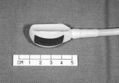 FIGURE 1. A right angle 7.5 MHz ultrasound probe. elective neck dissection and postoperative radiotherapy should therefore be considered in thick tumors.