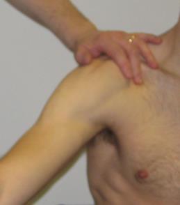 The SUPPORT Trial: SUbacromial impingement syndrome and Pain: a randomised controlled trial Of