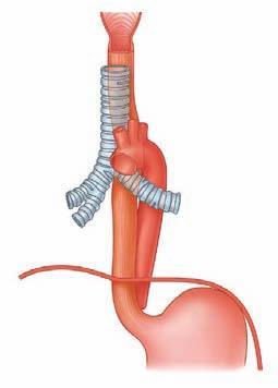 Regional anatomy Mediastinum 3 Pharynx Esophagus Trachea Position of esophagus posterior to left atrium Junction of esophagus with pharynx Where esophagus is crossed by arch of aorta Where esophagus