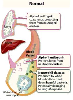 What is Alpha-1 Antitrypsin? Its main function is to protect the lung against proteolytic damage from neutrophil elastase, which is secreted by neutrophils and macrophages during inflammation.