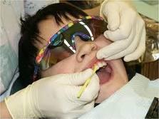 to prevent or arrest dental caries The concentration